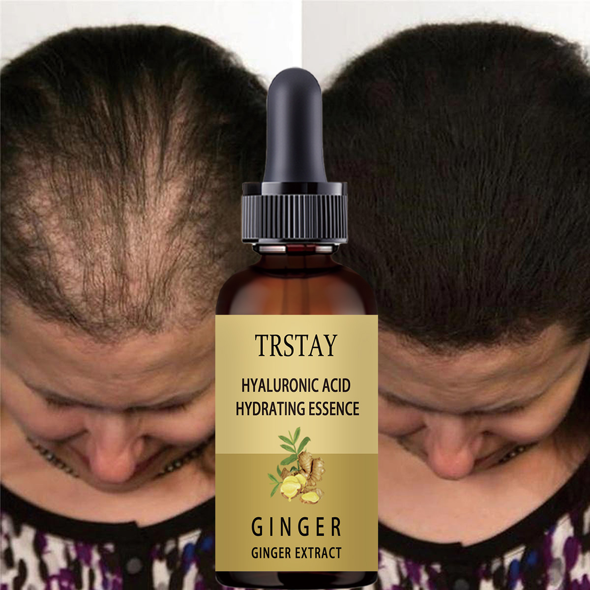 Hair Growth Serum Anti Prevent - Hair Care Gisou recension och pris