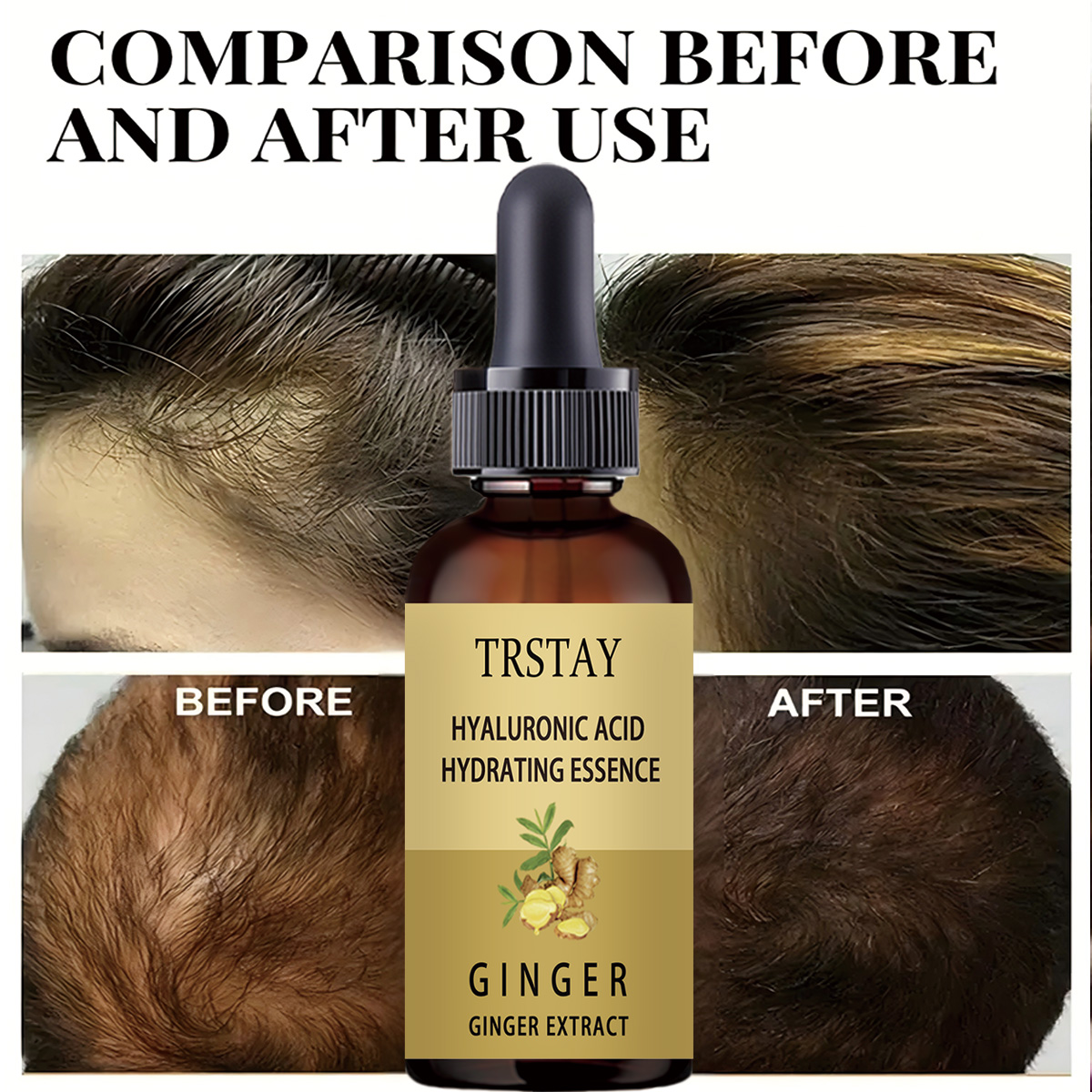 Hair Growth Serum Anti Prevent - Hair Care Gisou recension och pris
