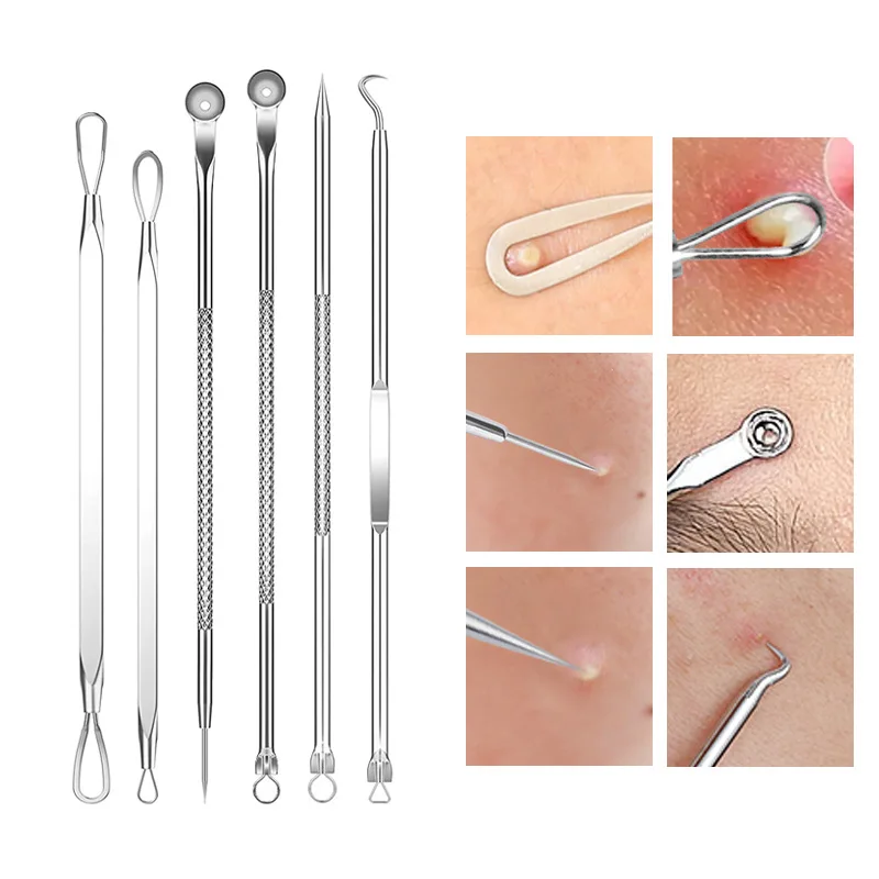 4-11Pcs Ingrown Hair Tweezers  - Hair Care Clinic recension och pris