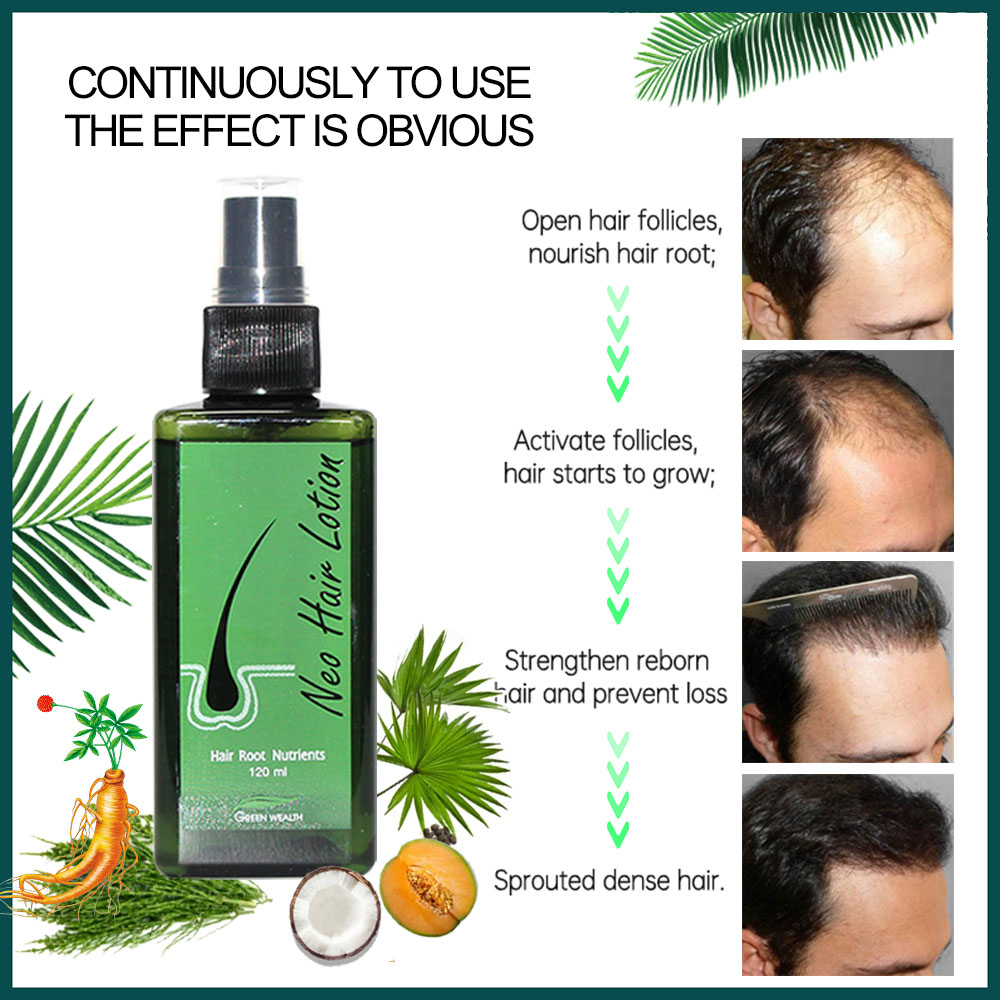 Original Neo Hair Lotion 120ml - Hair Care Gisou recension och pris